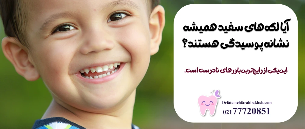 علت لکههای سفید روی دندان کودک و بهترین روش درمان