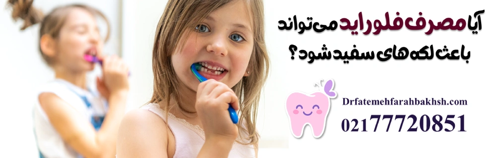 علت لکههای سفید روی دندان کودک و بهترین روش درمان