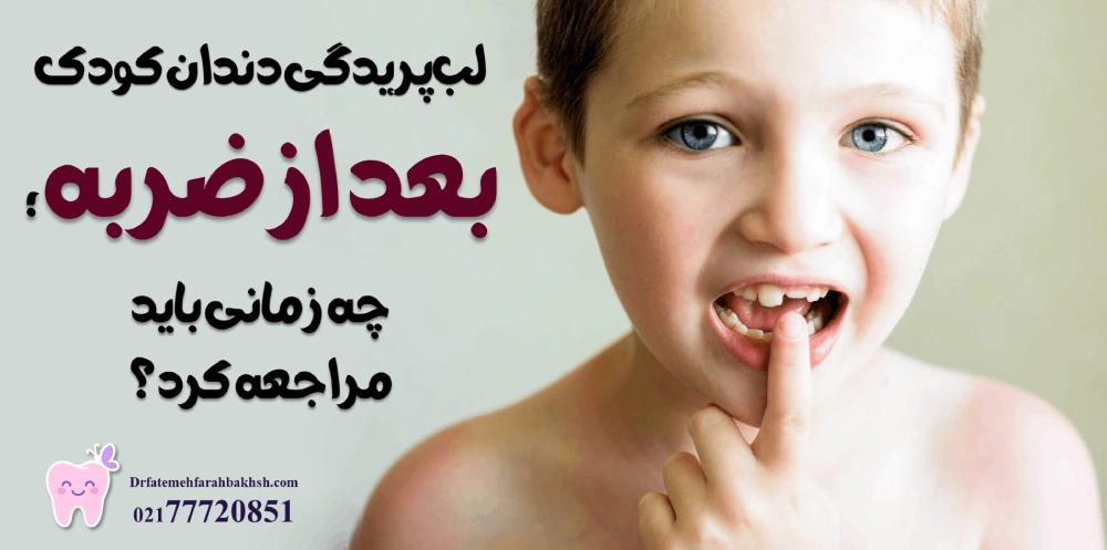 لبپریدگی دندان کودک بعد از ضربه؛ چه زمانی باید مراجعه کرد؟