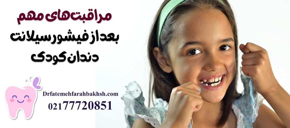 مراقبتهای مهم بعد از فیشورسیلانت دندان کودک