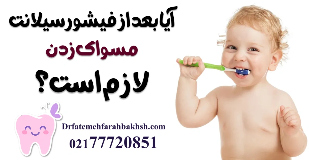 مراقبتهای مهم بعد از فیشورسیلانت دندان کودک