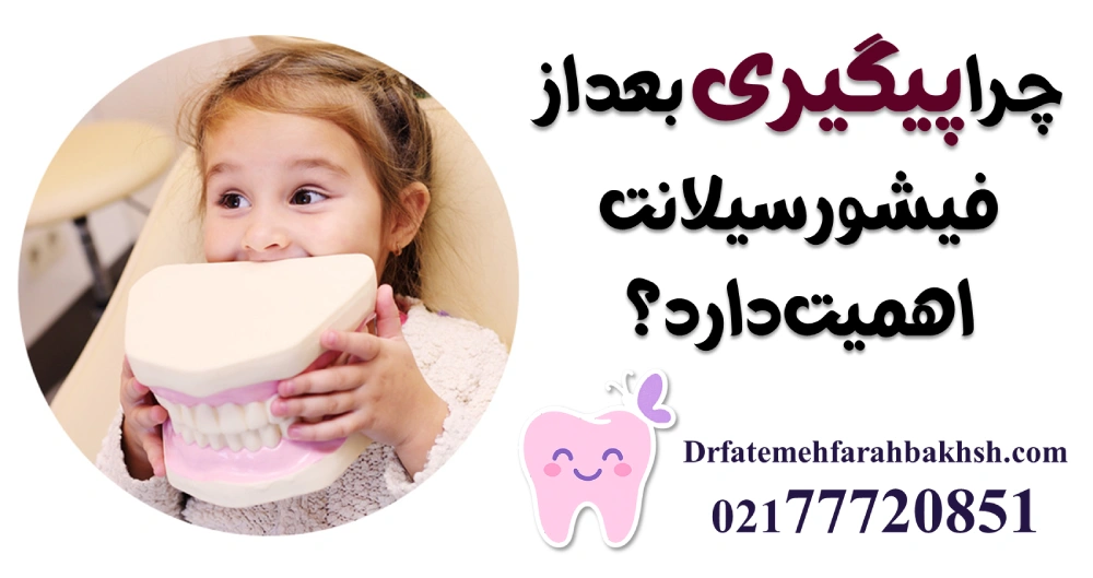 مراقبتهای مهم بعد از فیشورسیلانت دندان کودک