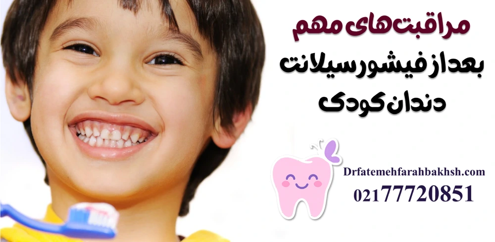مراقبت‌های مهم بعد از فیشورسیلانت دندان کودک