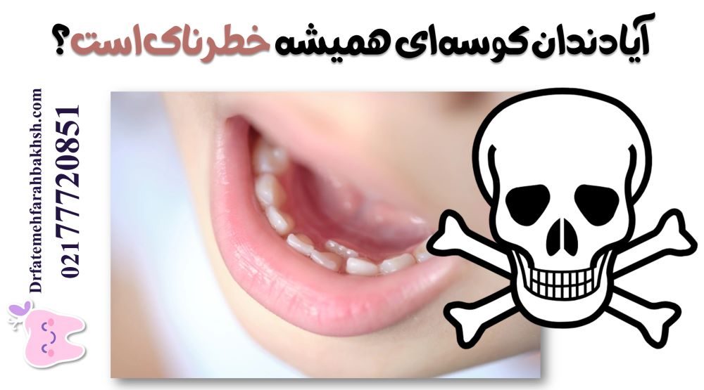 آیا دندان کوسه‌ای همیشه خطرناک است؟