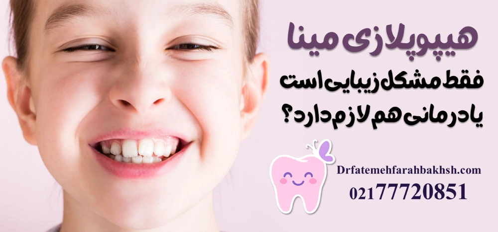 اهمیت استفاده از فضانگهدار پس از کشیدن دندان شیری