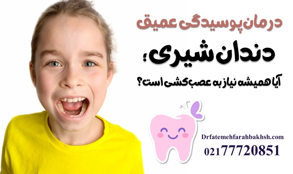 درمان پوسیدگی عمیق دندان شیری؛ آیا همیشه نیاز به عصب‌کشی است؟
