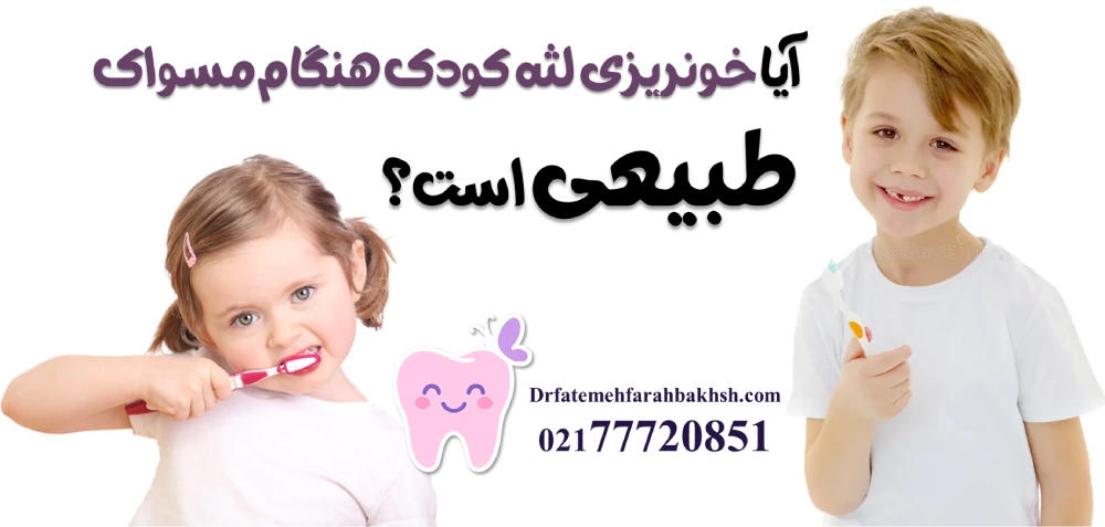 علل خونریزی لثه کودک هنگام مسواک
