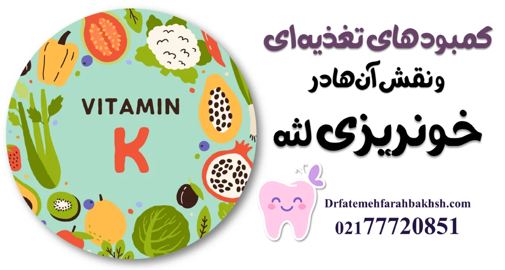 علل خونریزی لثه کودک هنگام مسواک