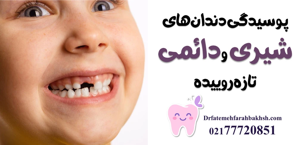 مشکلات شایع دندانی در کودکان ۵ تا ۱۰ سال