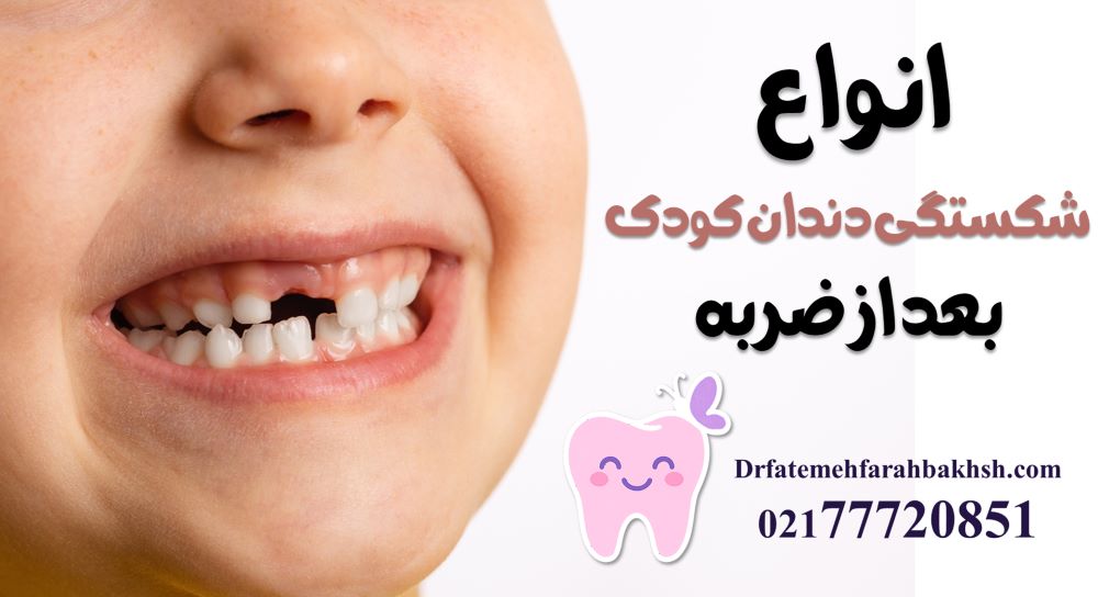 درمان دندان شکسته کودک بعد از زمین خوردن