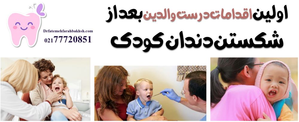 درمان دندان شکسته کودک بعد از زمین خوردن